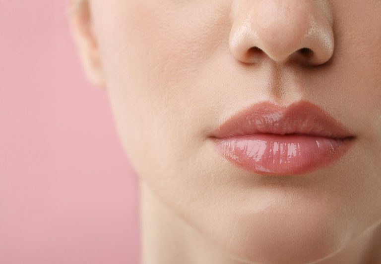 lip-filler-result